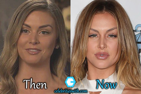 Lala Kent Plastic Surgery Picture Lala Kent Plastic Surgery Picture