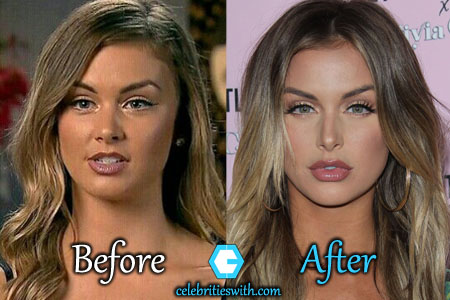 Lala Kent Plastic Surgery Lala Kent Plastic Surgery