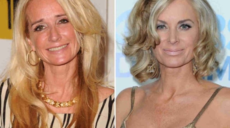 Kim Richards before and after cosmetic surgery