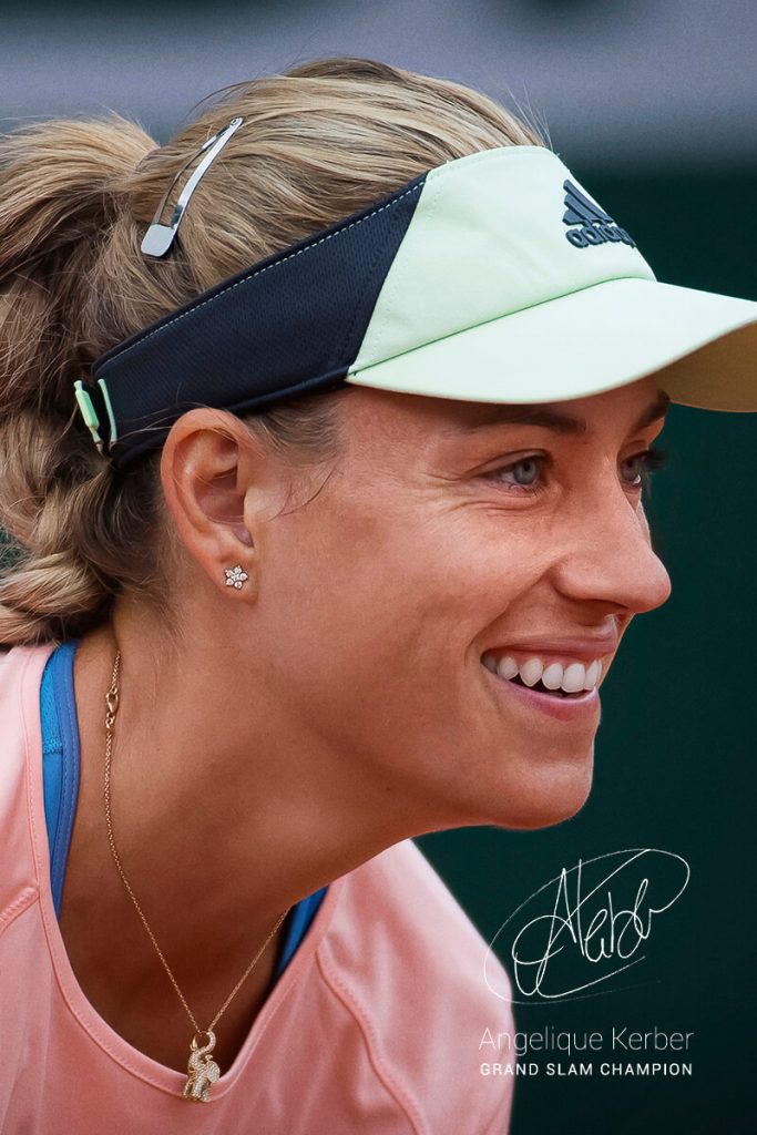 Angelique Kerber Cosmetic Surgery Face