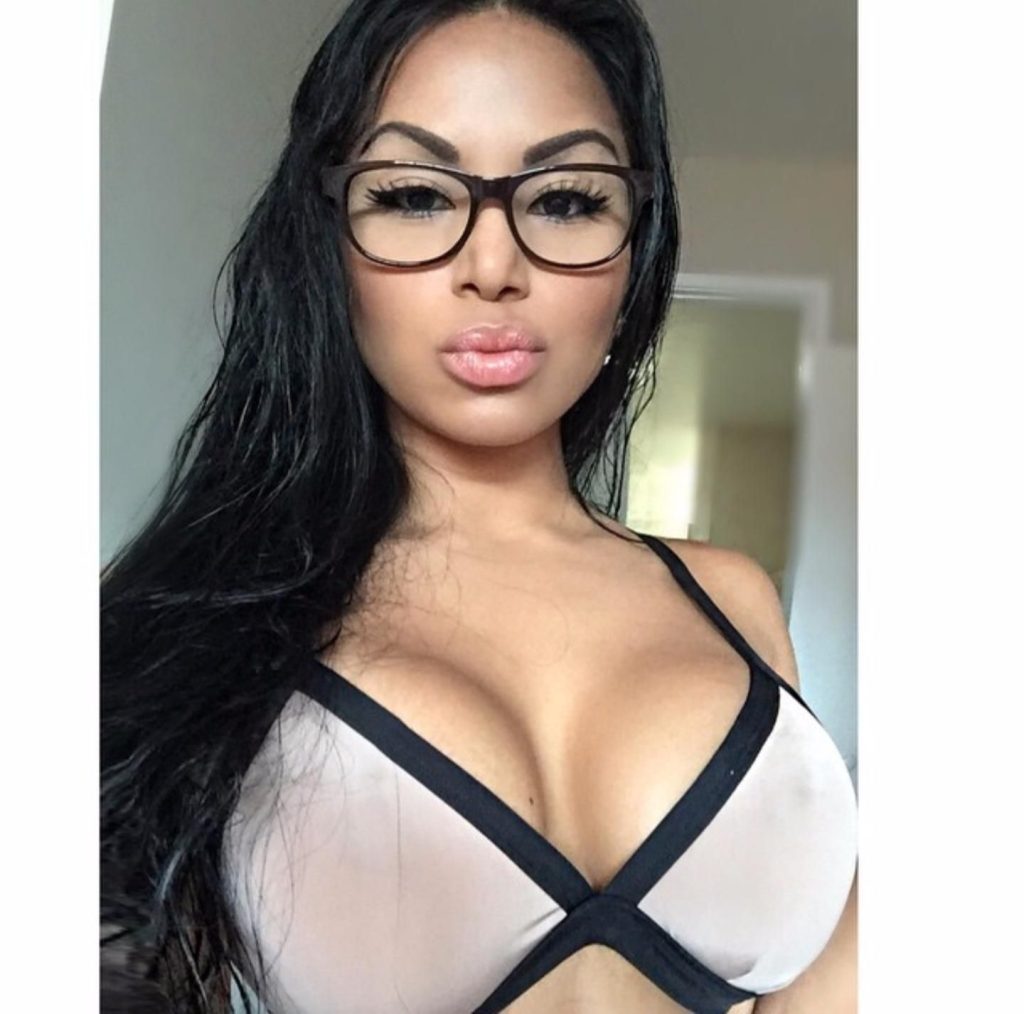 Dolly Castro Boob Job plastic surgery