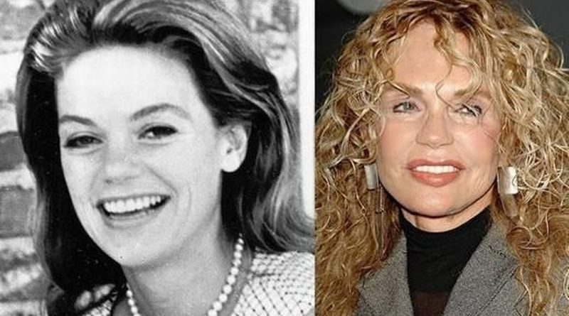 Dyan Cannon Plastic Surgery and Body Measurements