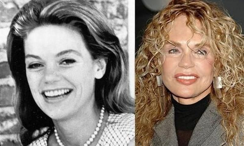 Dyan Cannon Plastic Surgery and Body Measurements