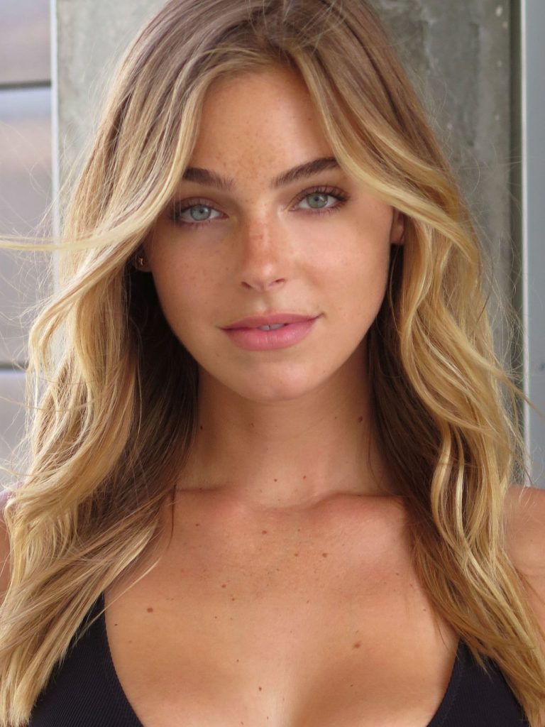 Elizabeth Turner Plastic Surgery Face