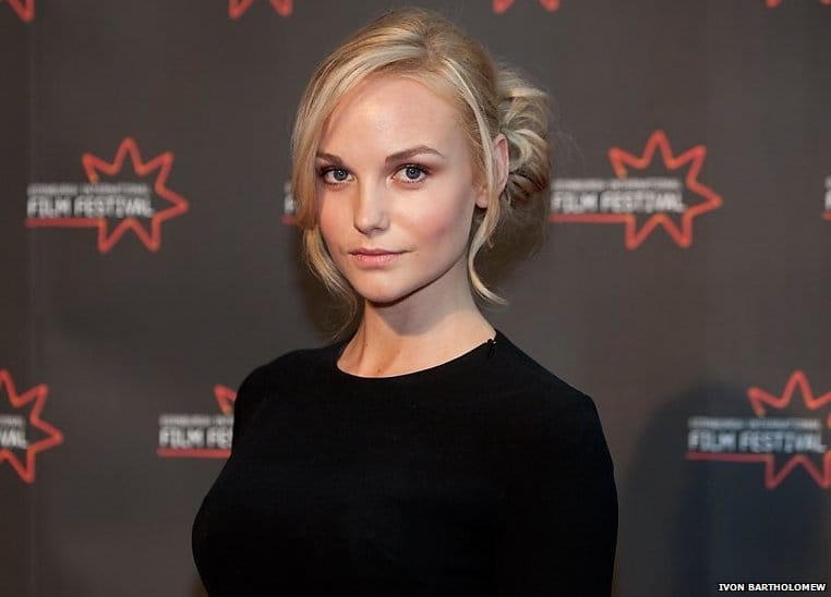 Joanna Vanderham Plastic Surgery
