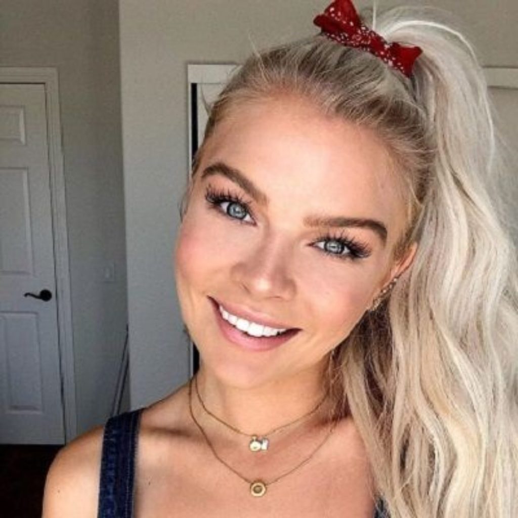 Kelli Goss Cosmetic Surgery Face