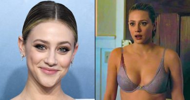 Lili Reinhart Plastic Surgery