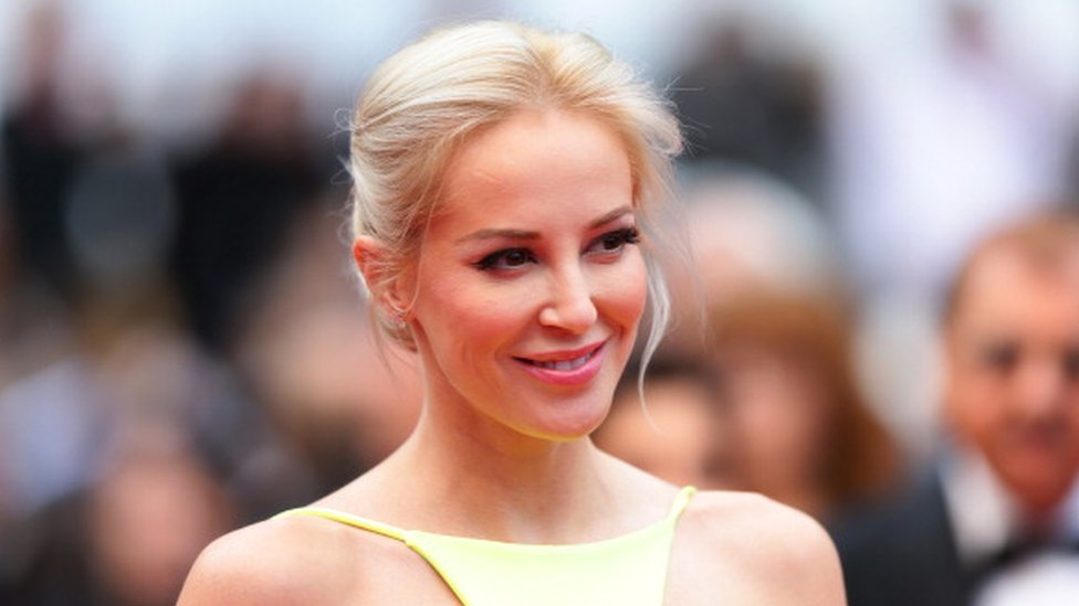 Louise Linton Cosmetic Surgery Face