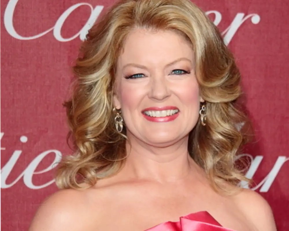 Mary Hart Cosmetic Surgery Face