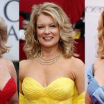 Mary Hart Plastic Surgery