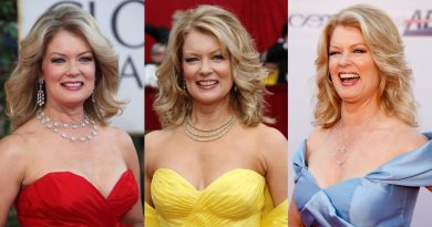 Mary Hart Plastic Surgery