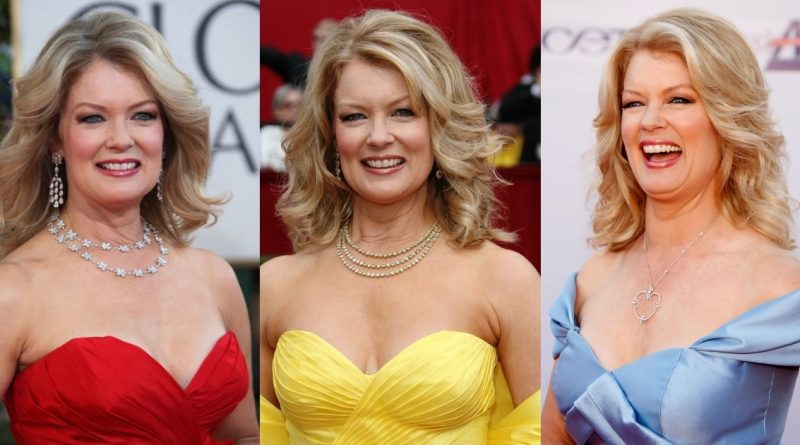 Mary Hart Plastic Surgery