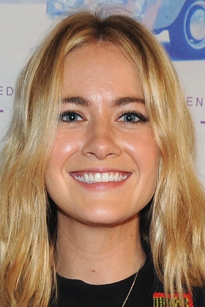 Meredith Hagner Plastic Surgery Face