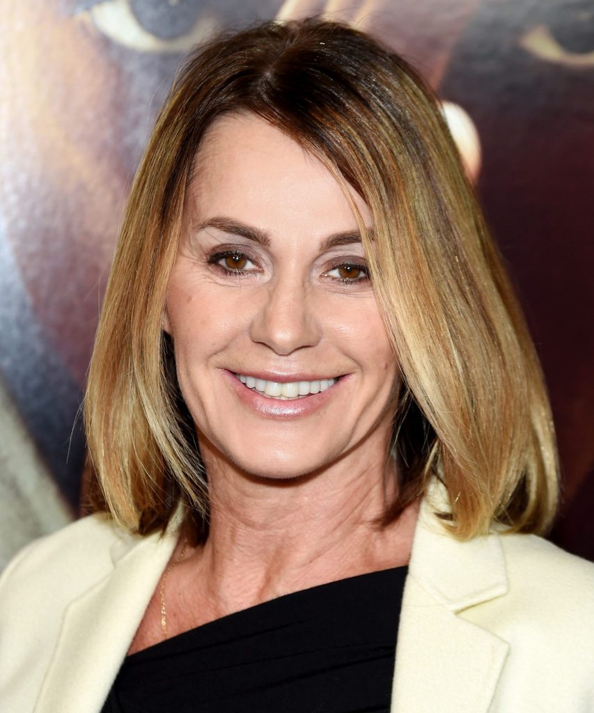 Nadia Comaneci Boob Job plastic surgery