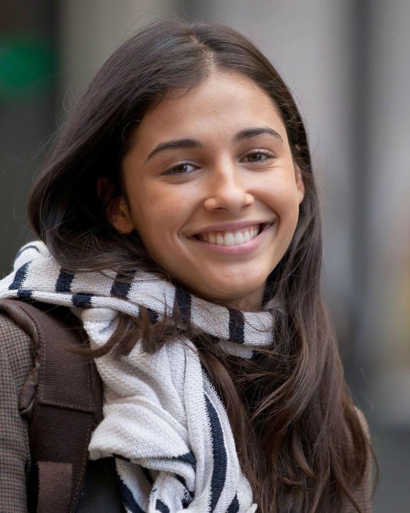 Naomi Scott Cosmetic Surgery Face