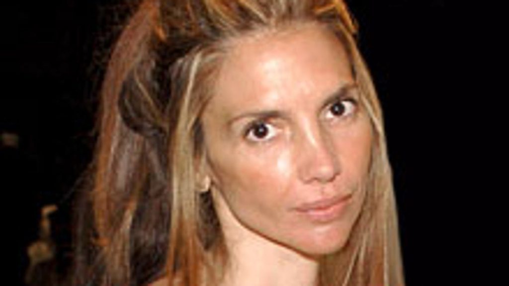 Nicolette Scorsese Cosmetic Surgery Face