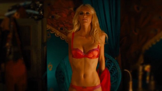 Poppy Delevingne Plastic Surgery