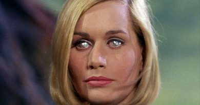 Sally Kellerman Plastic Surgery