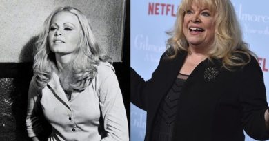 Sally Struthers Plastic Surgery