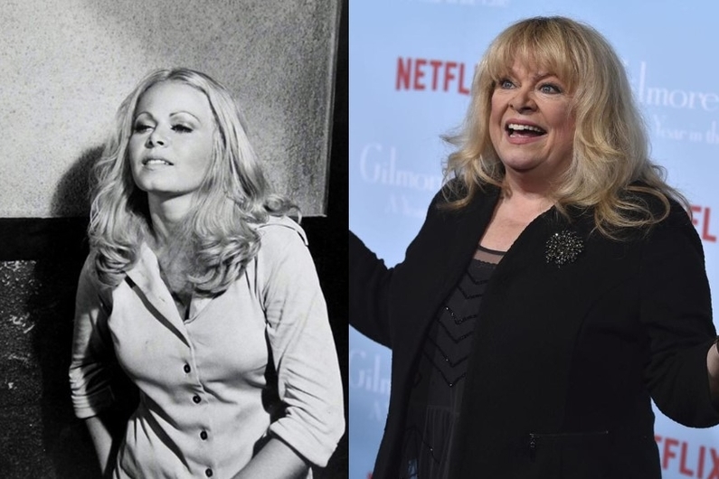 Sally Struthers Plastic Surgery