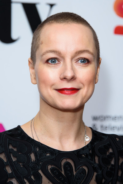 Samantha Morton Cosmetic Surgery Face