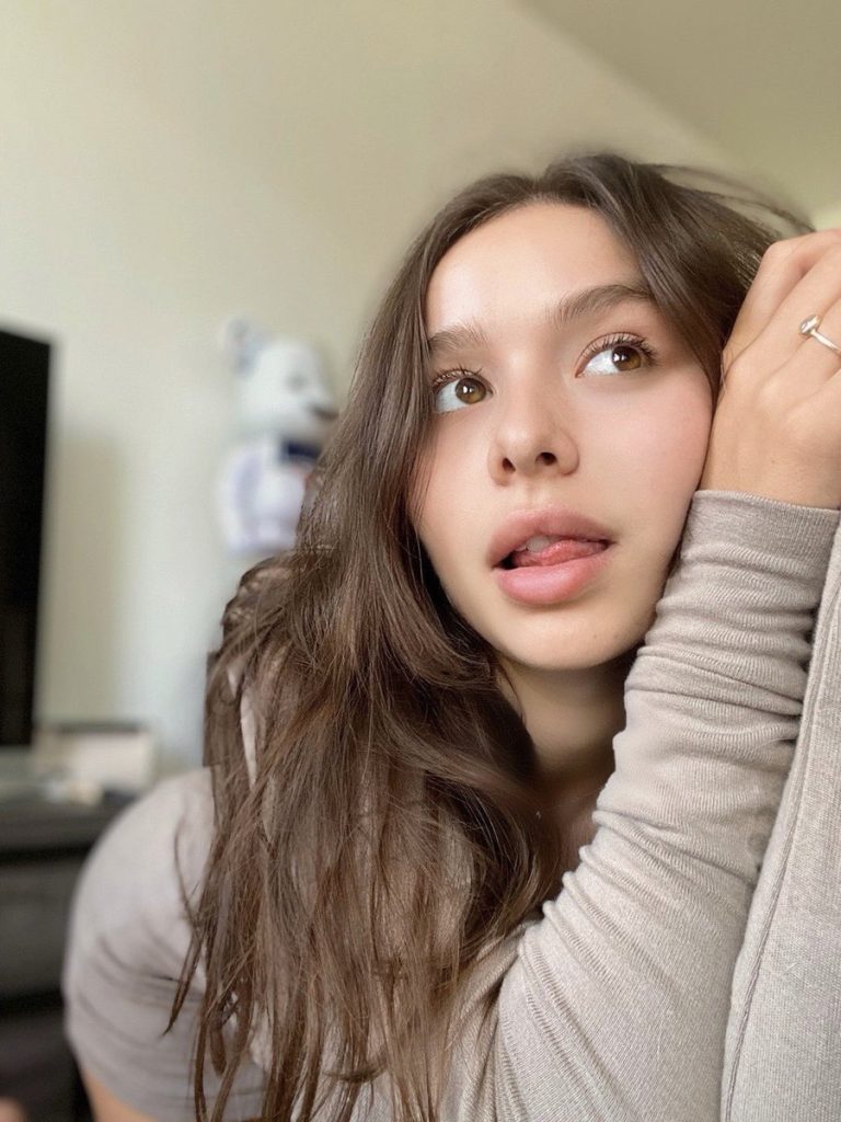 Sophie Mudd Cosmetic Surgery Face