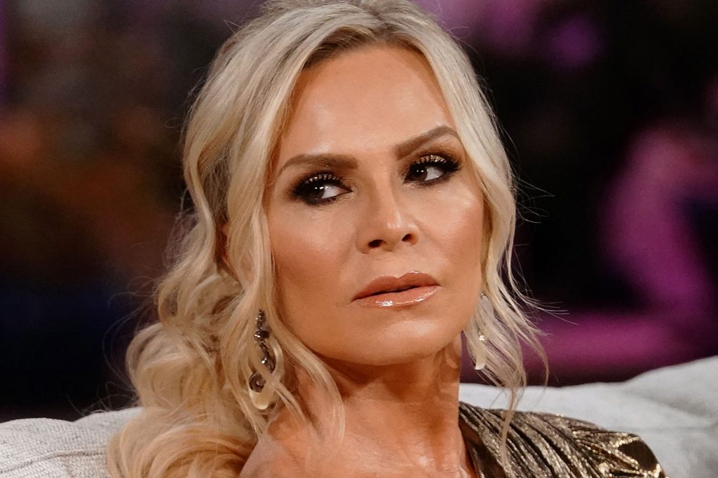 Tamra Judge Boob Job Facelift plastic surgery