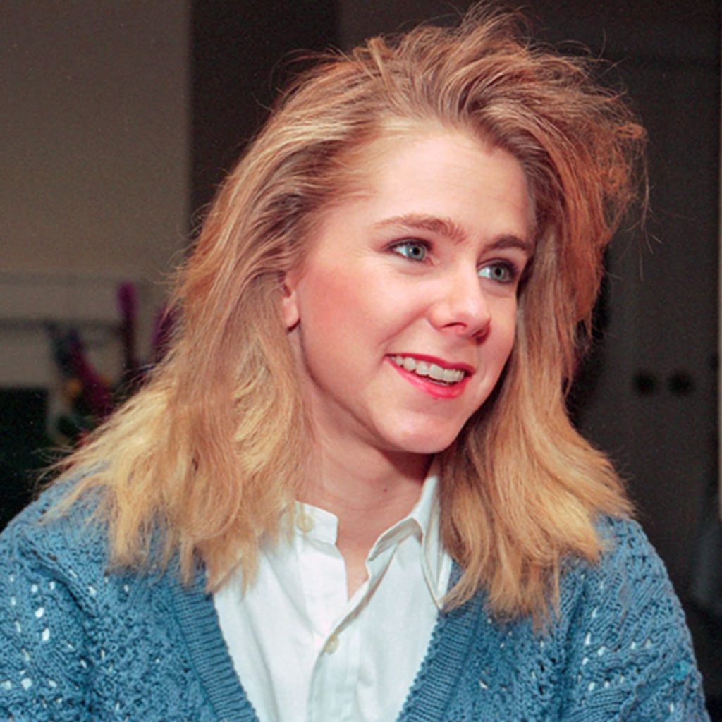 Tonya Harding Plastic Surgery Face