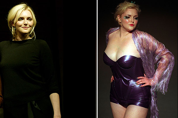 Sophie Dahl Plastic Surgery Body