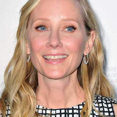 Anne Heche Cosmetic Surgery Face