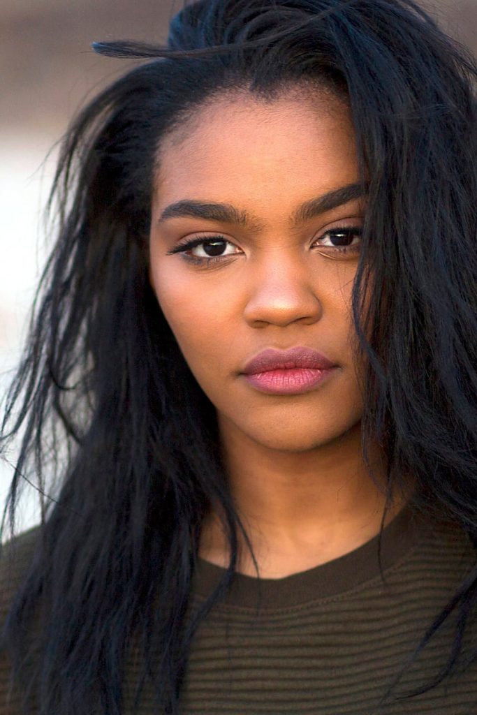 China Anne McClain Plastic Surgery Face