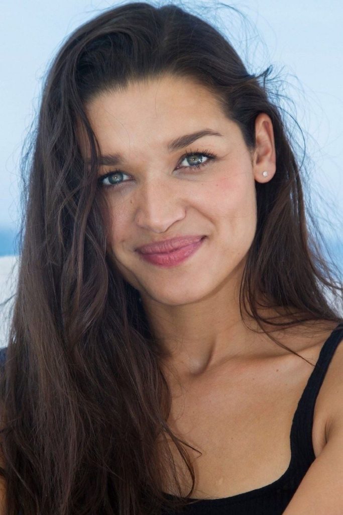 Kim Engelbrecht Plastic Surgery Face