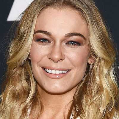 LeAnn Rimes Cosmetic Surgery Face