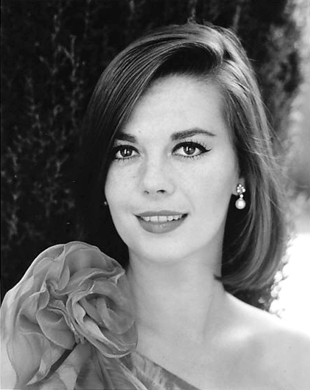 Natalie Wood Plastic Surgery Face