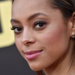 Amber Stevens Cosmetic Surgery