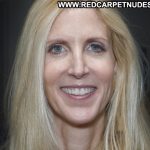 Ann Coulter Plastic Surgery Procedures
