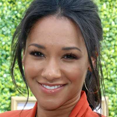 Candice Patton Cosmetic Surgery Face