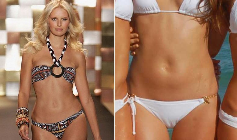 Karolina Kurkova Plastic Surgery Body