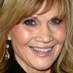 Markie Post Plastic Surgery Procedures