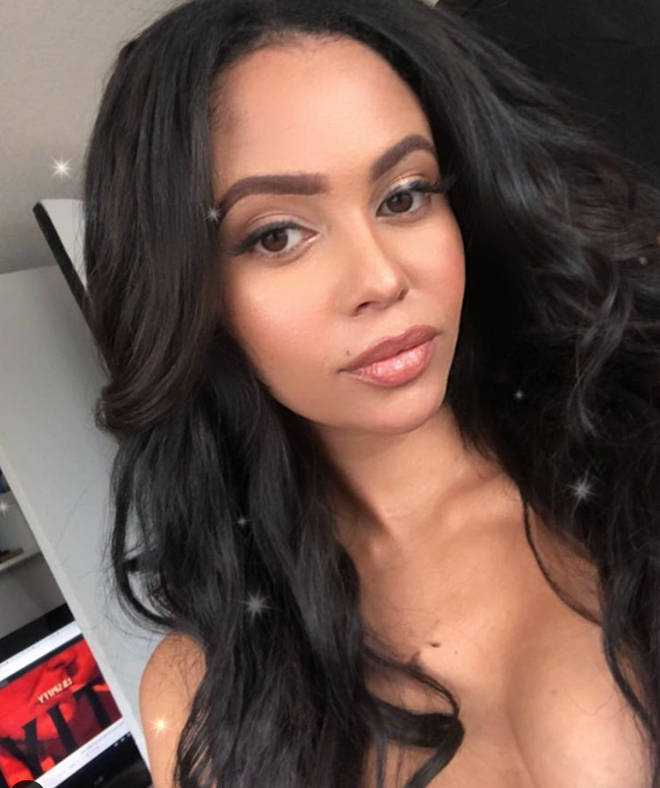 Vanessa Morgan Cosmetic Surgery Face