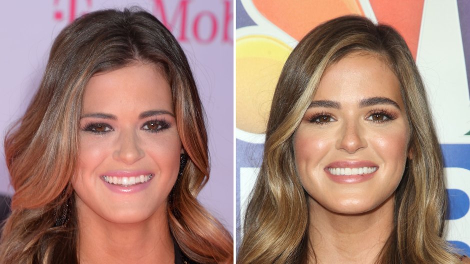 JoJo Fletcher Cosmetic Surgery Face