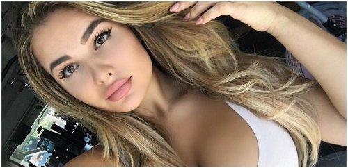 Anastasiya Kvitko Plastic Surgery Face