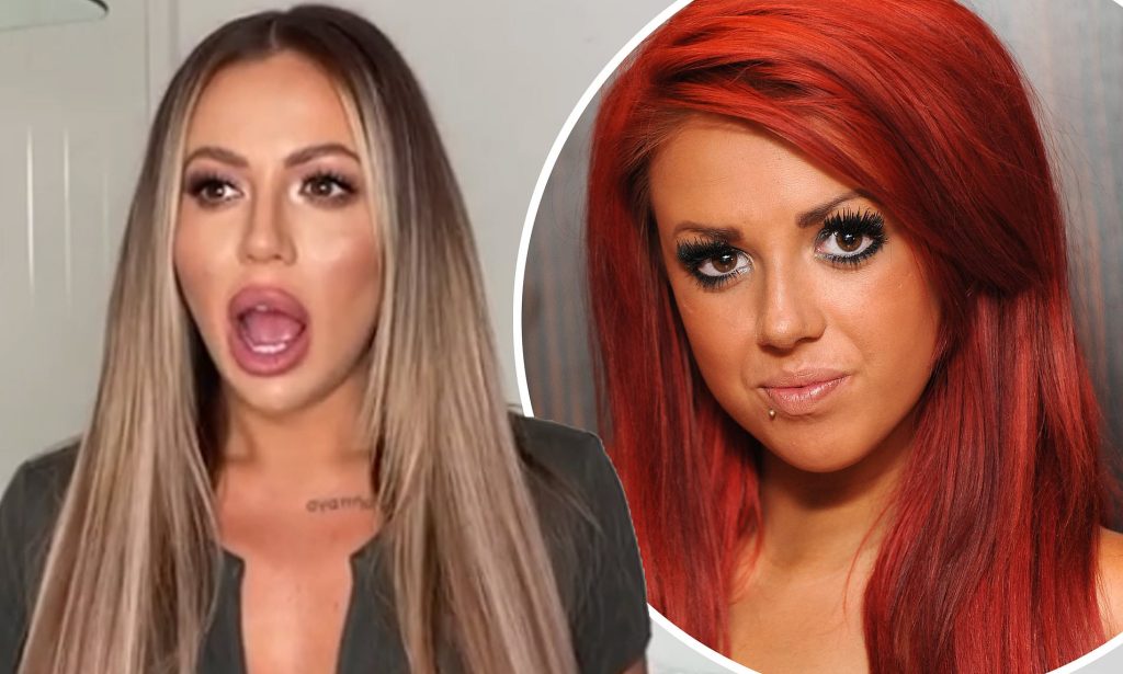 Holly Hagan Cosmetic Surgery Face