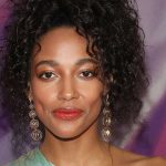 Kylie Bunbury Cosmetic Surgery