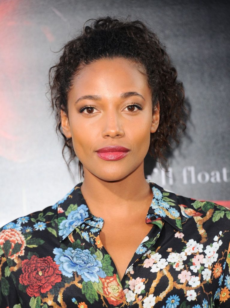 Kylie Bunbury Cosmetic Surgery Face