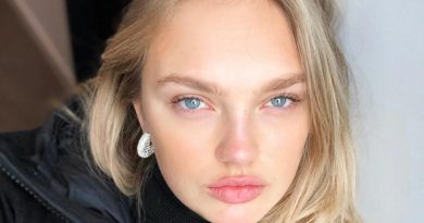 Romee Strijd Cosmetic Surgery