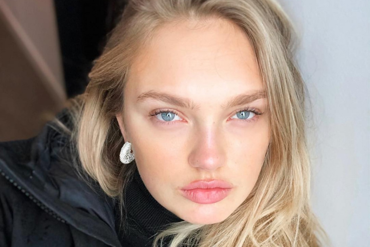 Romee Strijd Cosmetic Surgery