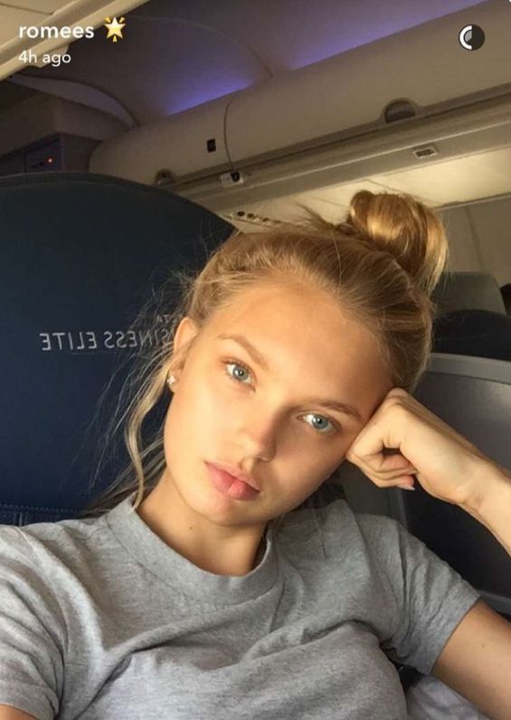 Romee Strijd Plastic Surgery Face