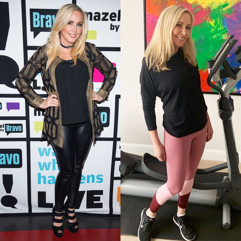 Shannon Beador Fillers