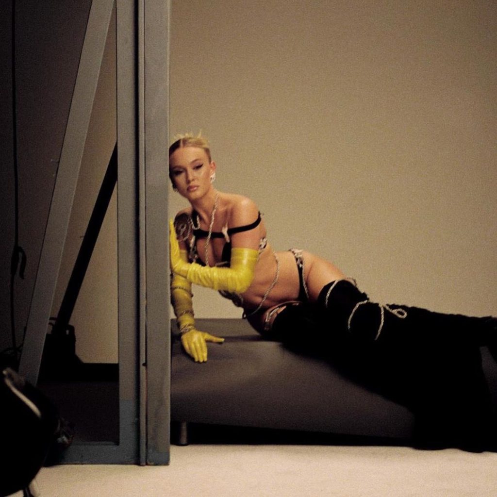Zara Larsson Plastic Surgery Body